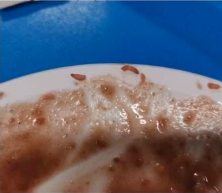 La enfermera adjuntó una fotografía en donde se aprecian pequeñas larvas en los alimentos (Captura de pantalla)