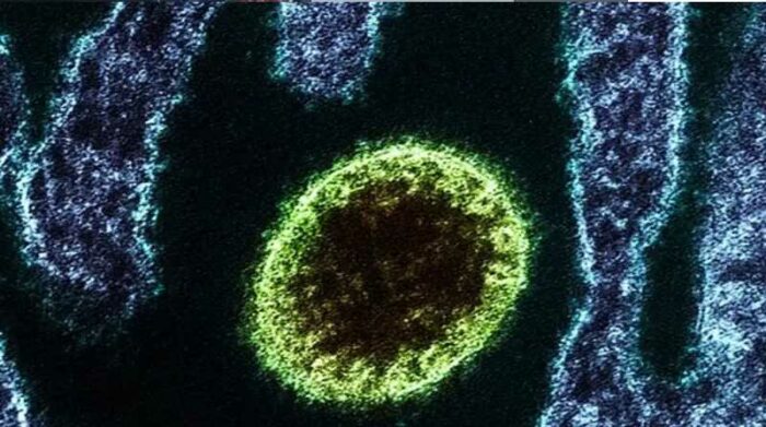 El nuevo henipavirus Langya (LayV) se detectó por primera vez en las provincias nororientales de Shandong y Henan a finales de 2018