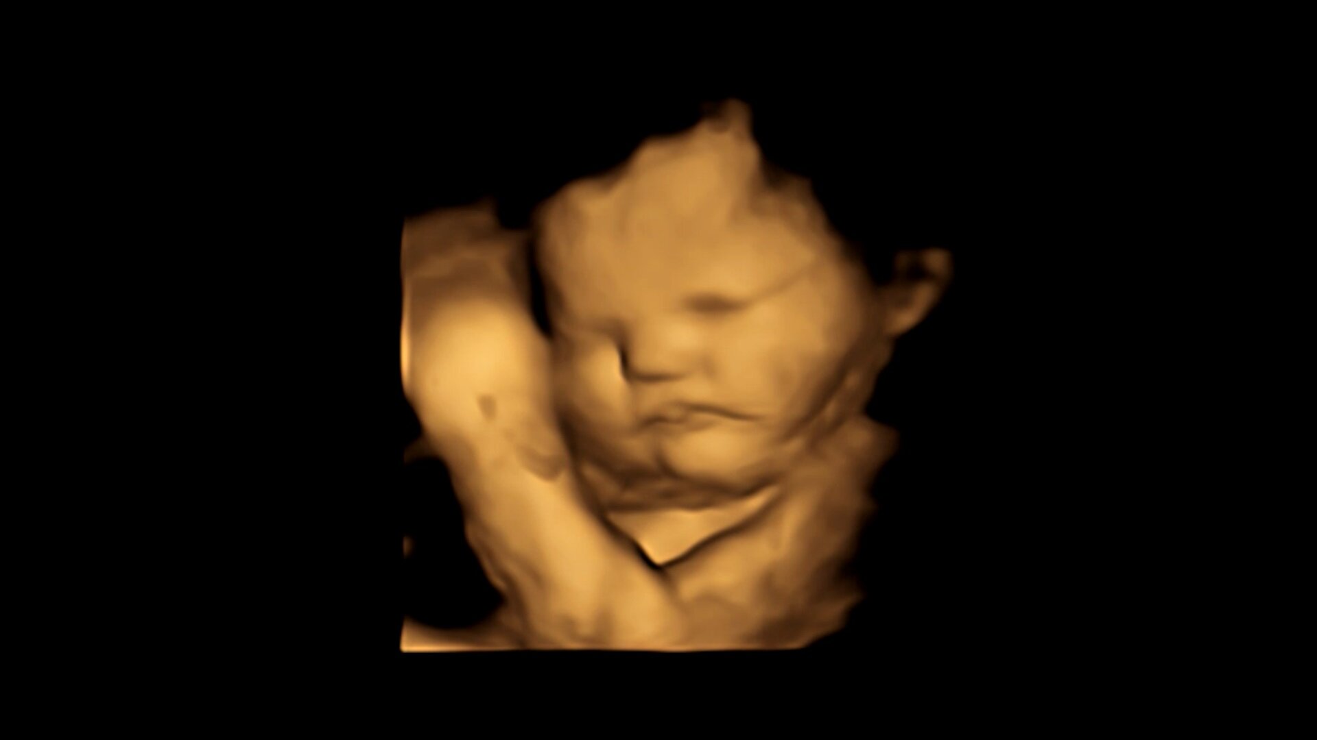 Fetus shows neutral face to kale / Credit: FETAP (Fetal Taste Preferences) Study, Fetal and Neonatal Research Laboratory, Durham University