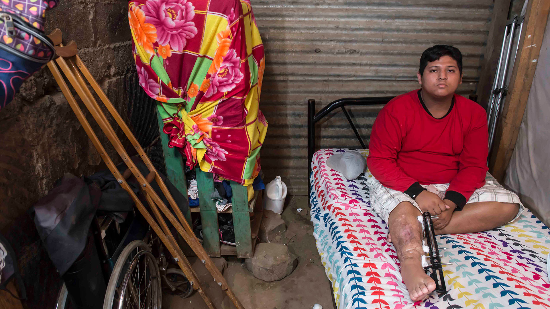  Isaac Ramírez vive con su madre en una pequeña casa con piso de tierra en un barrio de Managua. Esta foto fue tomada antes de que le amputaran la pierna. Foto: Óscar Navarrete