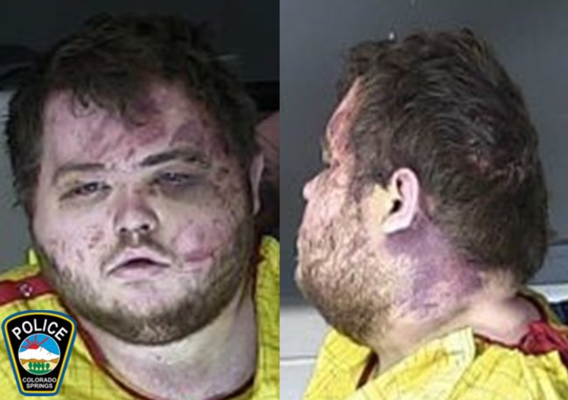After he divorced his wife, he stopped seeing his son since 2011, but last year he began to have contact with him, in fact, his wife had told him that Anderson had killed himself.  (Photo: Colorado Springs Police Department)