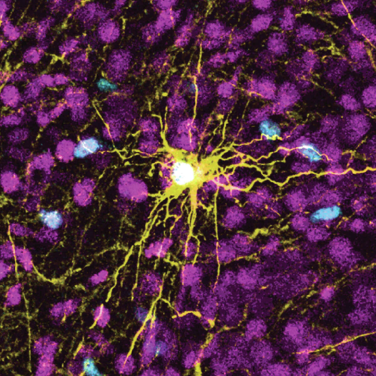Por qué implantar neuronas humanas en cerebros de ratas puede ayudar a explicar trastornos como el autismo 