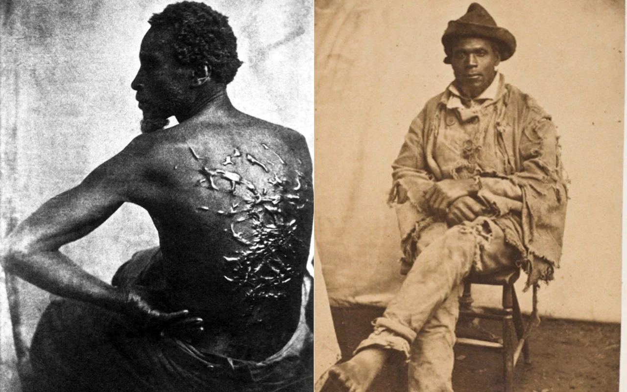 La espalda surcada por enormes cicatrices de “Peter azotado” que reveló el horror de la esclavitud