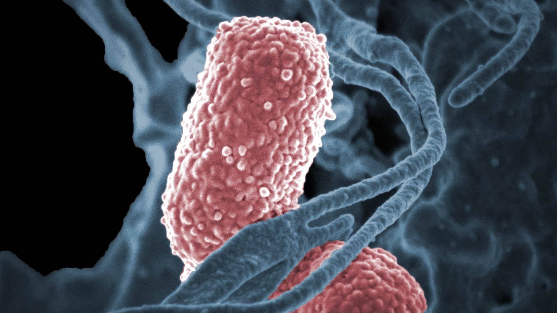 La bacteria Shigella causa afección gastrointestinal y también se la detecto en uno de las personas fallecidas en Berazategui (NIH)
