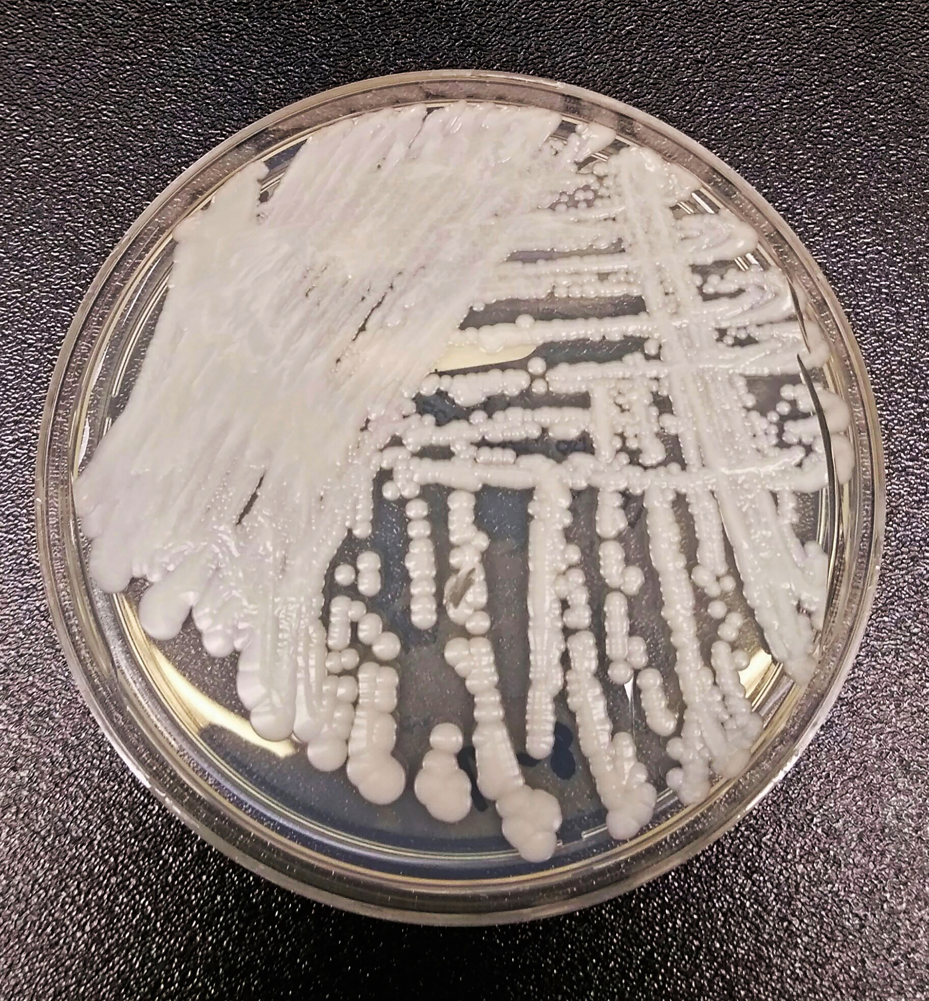 El hongo Candida auris cultivada en una placa de Petri. (CDC)