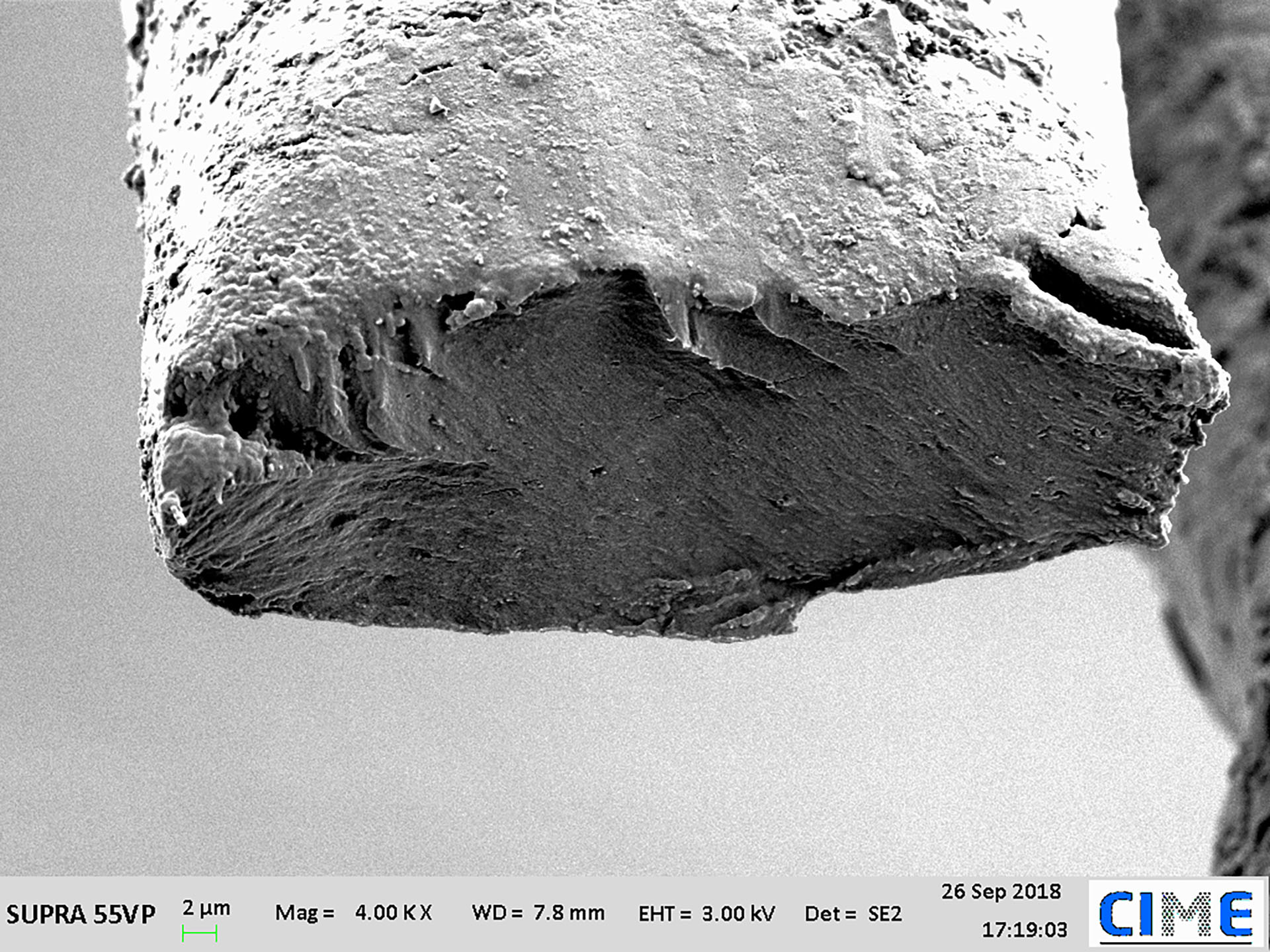 Fotos de microscopía electrónica del cabello humano y del corte transversal