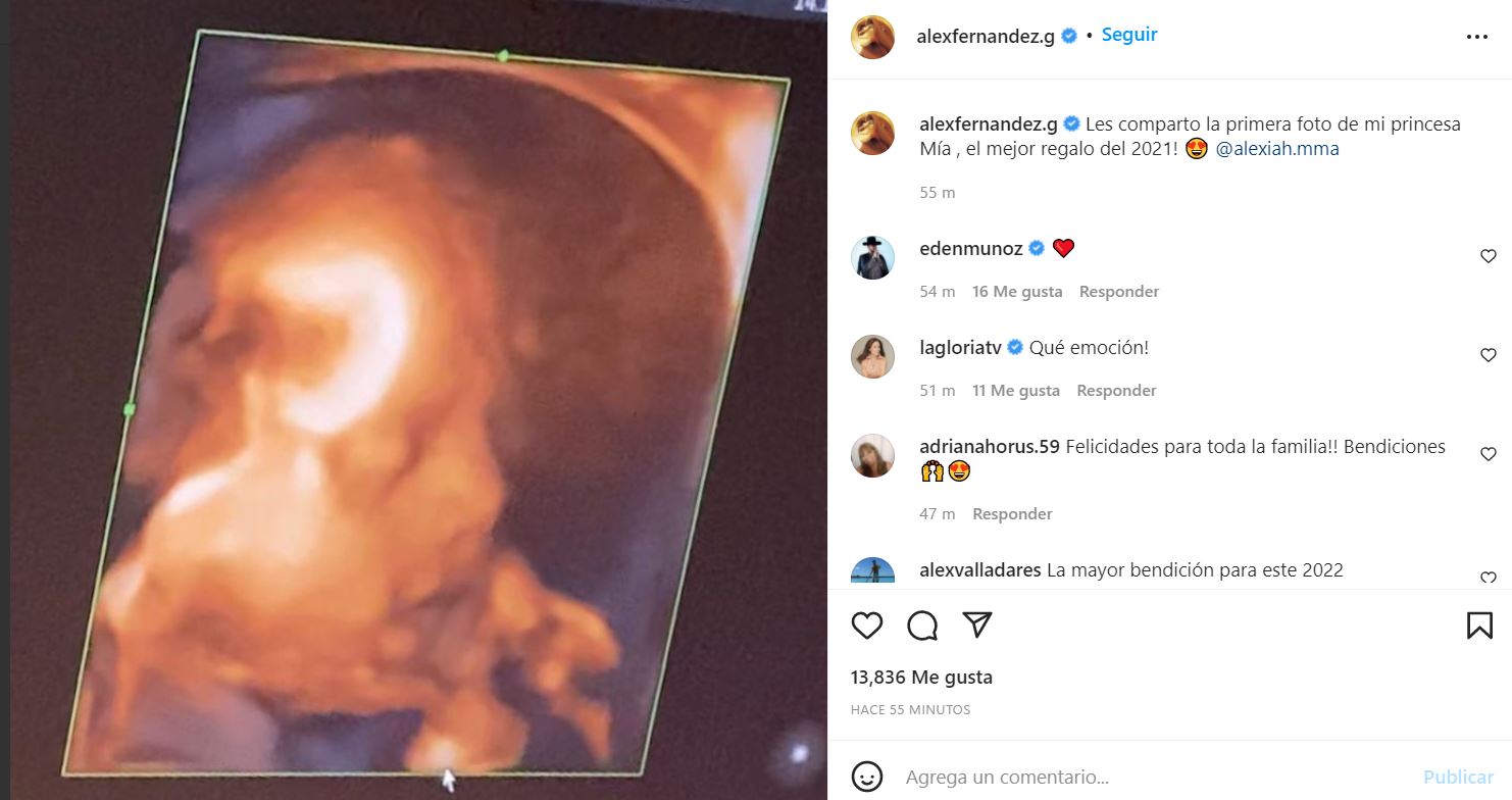 Alex Fernández mostró la primera ecografía 3D de su bebé Mía (Foto: captura de pantalla/Instagram)