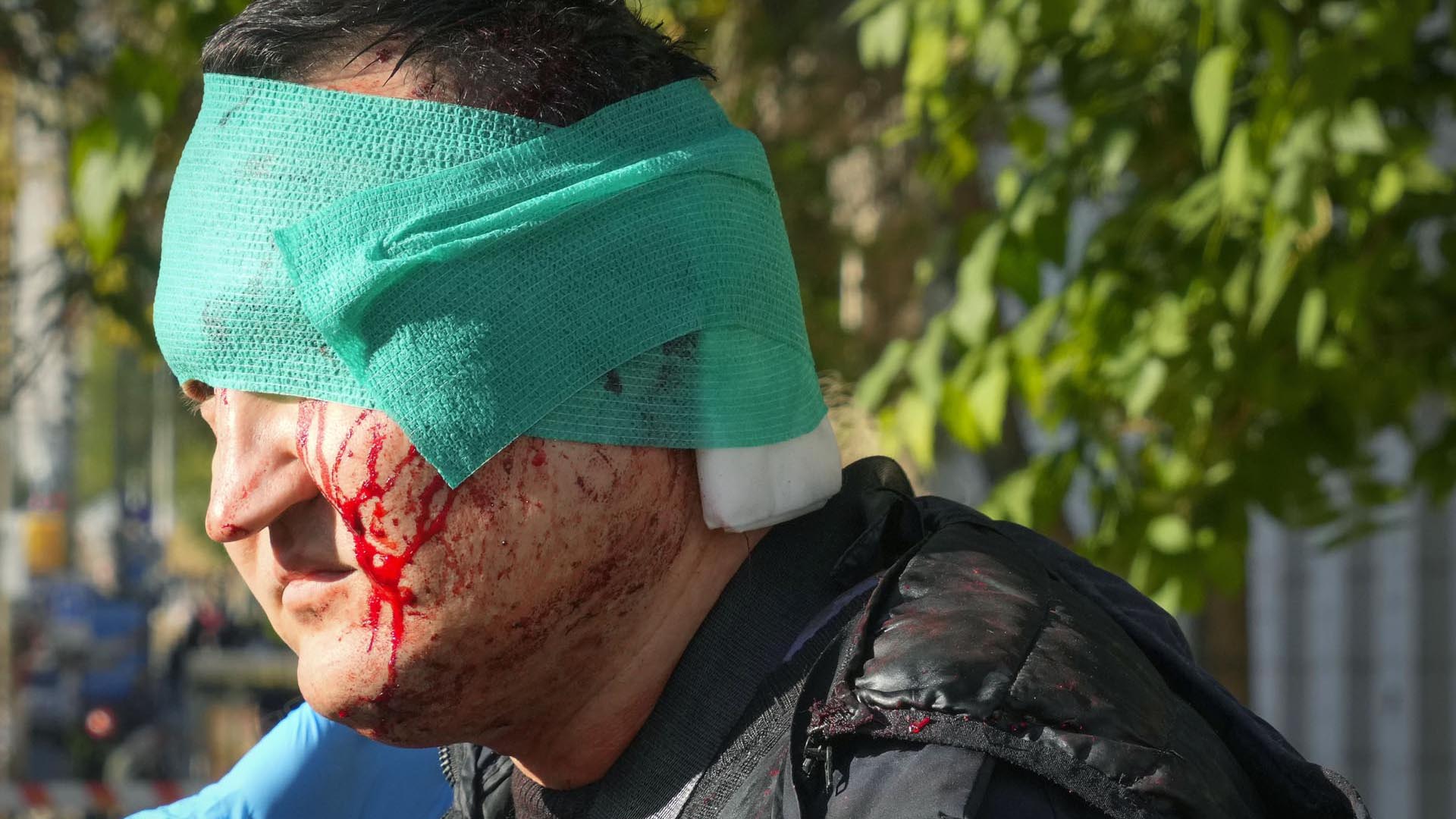 Un hombre herido en Kiev tras el ataque de Putin (AP/Efrem Lukatsky)