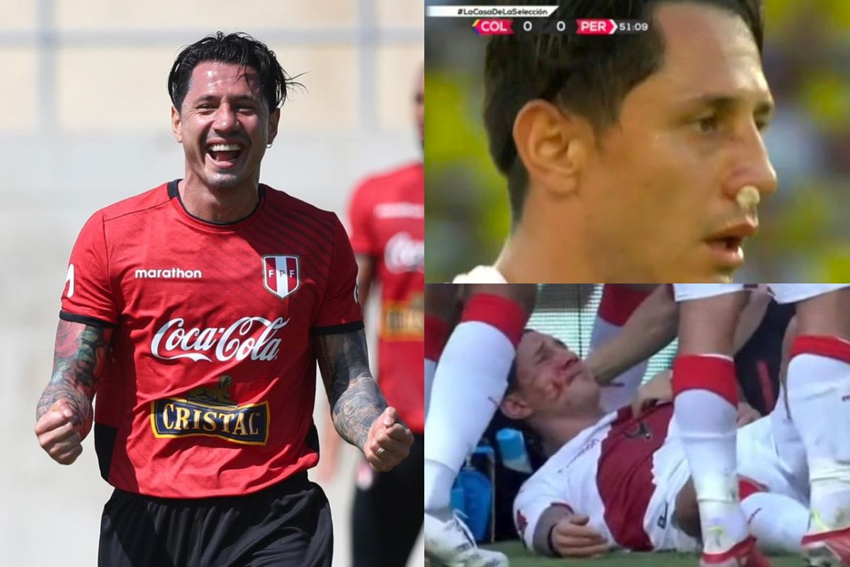 Gianluca Lapadula y la impresionante desviación de tabique de su nariz tras golpe en triunfo de Perú