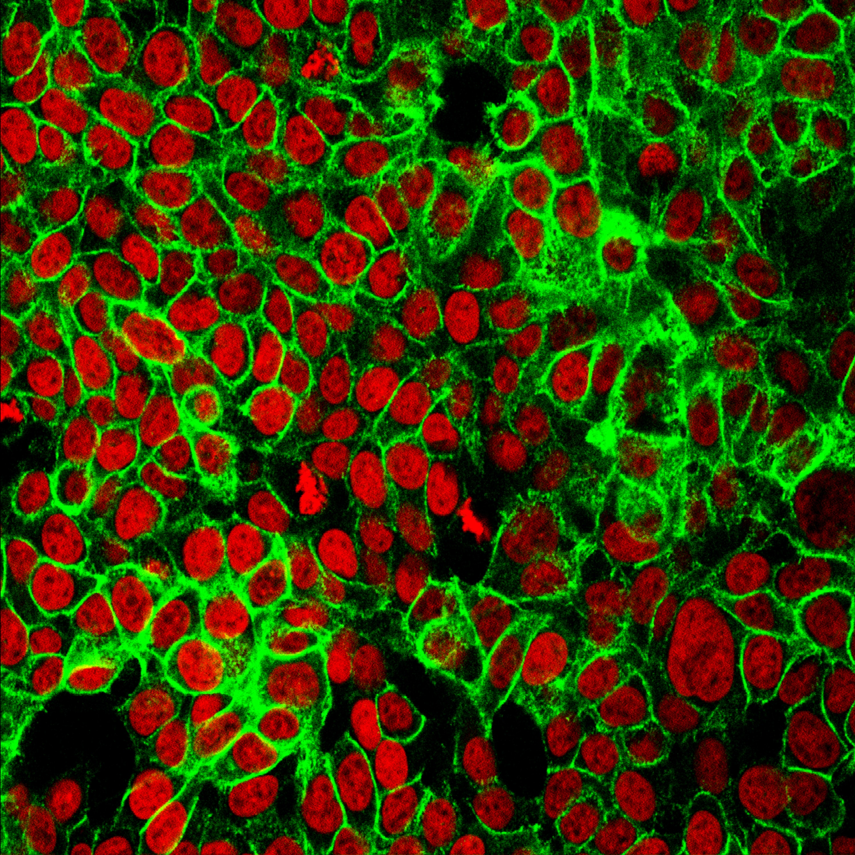 Las células T son ahora el foco de atención de la ciencia frente al COVID (NIH)