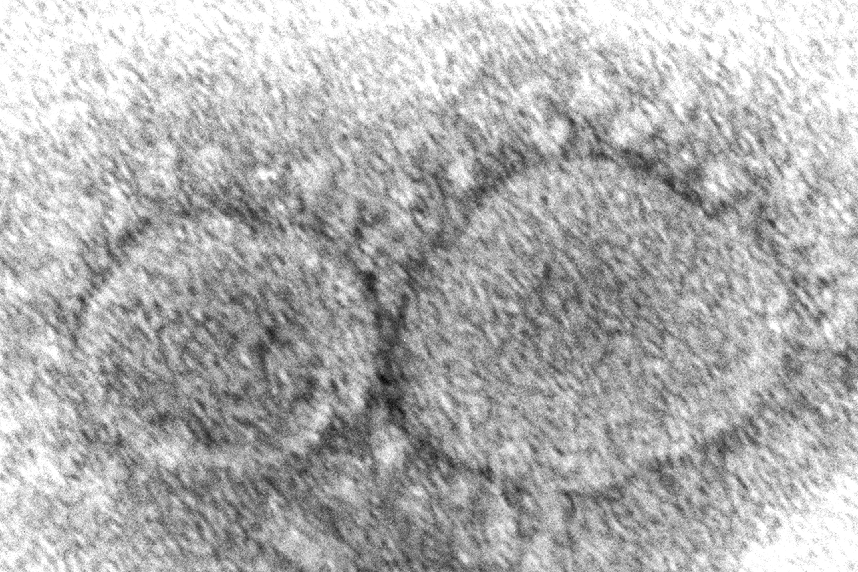 La imagen de microscopio electrónico distribuida por los Centros de Control y Prevención de enfermedades muestra partículas de virus SARS-CoV-2, que causa COVID-19. (Hannah A. Bullock, Azaibi Tamin/CDC via AP, File)