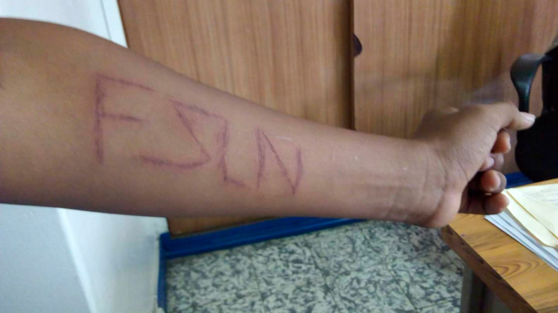 Un adolescente fue detenido por policías cuando iba  camino al colegio. Le tatuaron en sangre las siglas del partido gobernante en Nicaragua. (Foto cortesía)