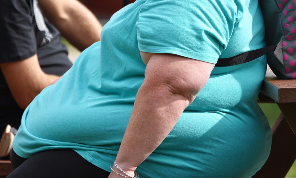Según la doctora Mónica Katz, “la obesidad es portera de más de 200 enfermedades” (Foto: Europa Press)
