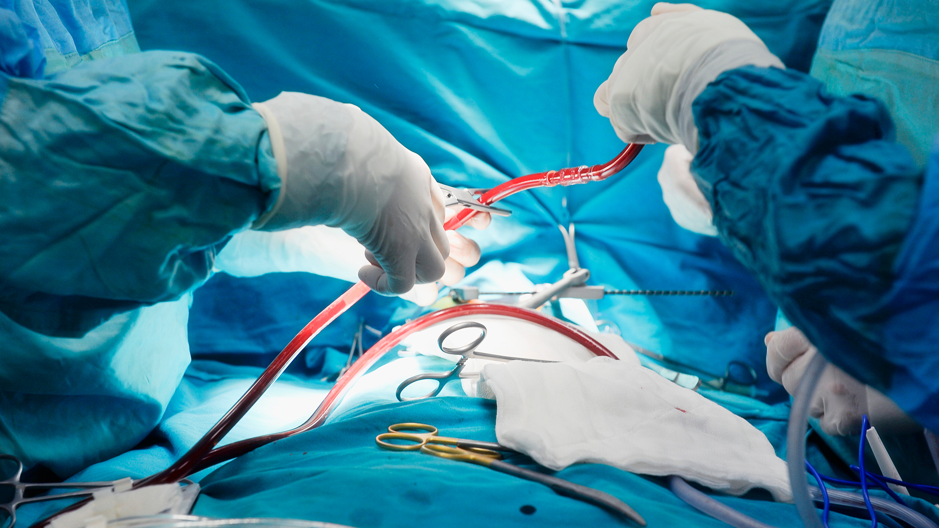 Ya se han hecho reprogramaciones de cirugías por la escasez de productos médicos (Getty Images)