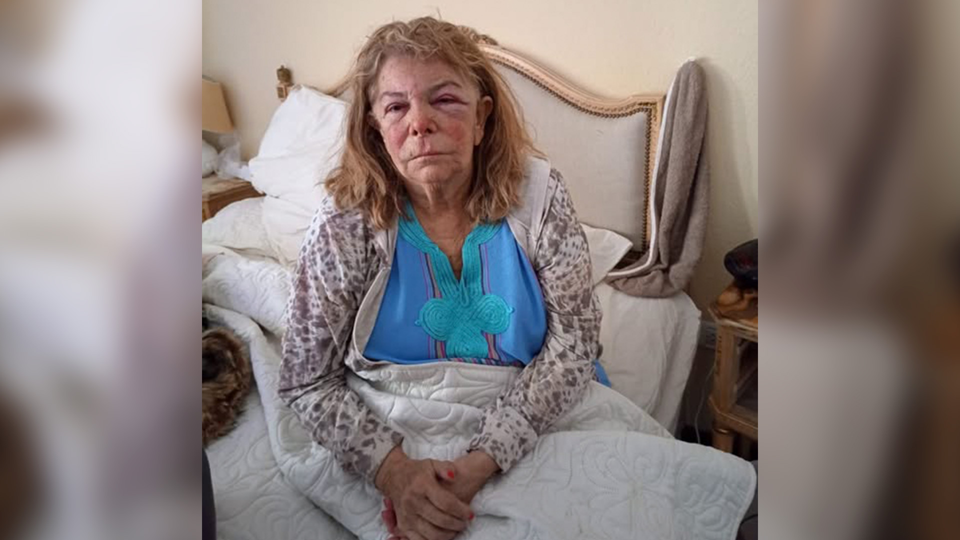 Violenta entradera a una jubilada en Mar del Plata: "Me pegaron, me ataron y me pedían dólares"