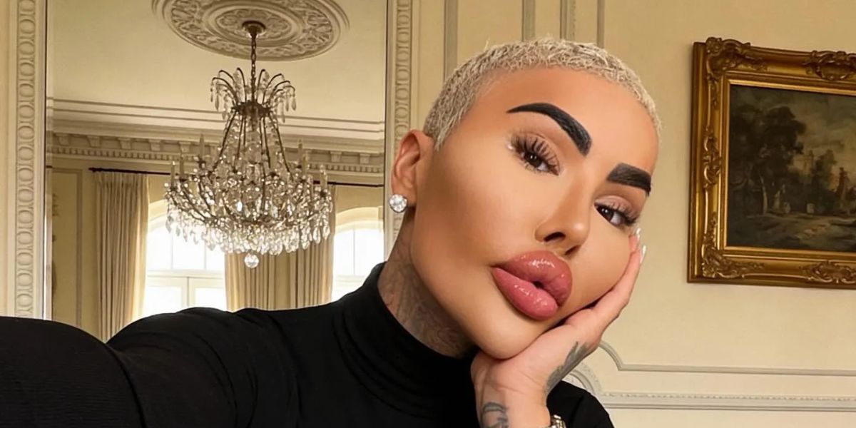 Quién es el hombre que fue atacado con un fierro en la cabeza en la discusión de tránsito de Castelar