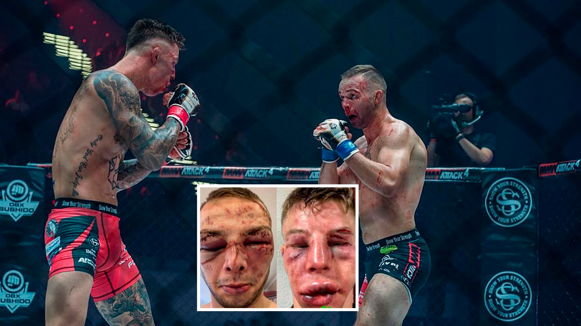 Así quedó el rostro de dos luchadores de MMA tras protagonizar “la pelea más sangrienta de la historia”