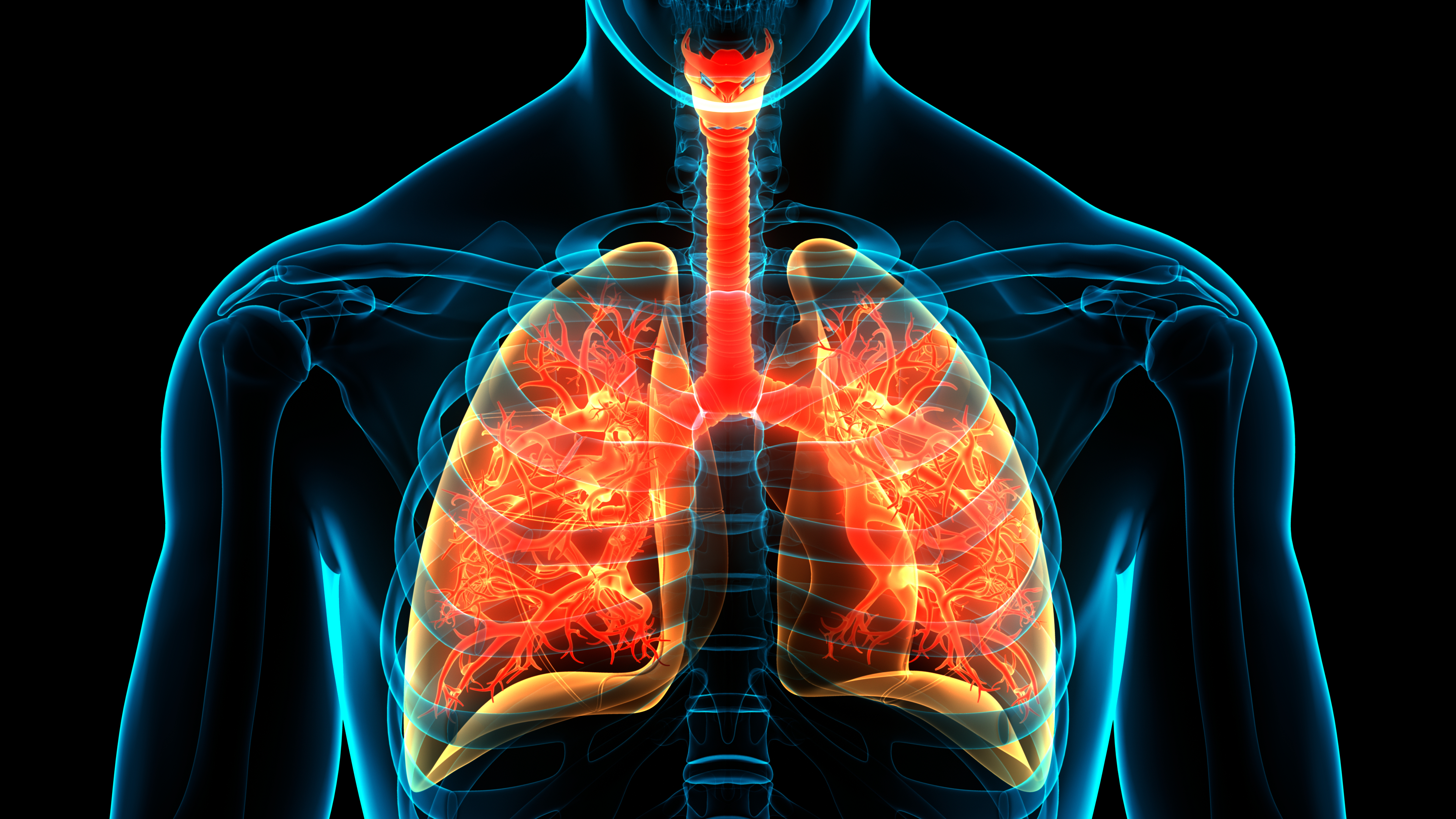 La sobreproducción de moco se ha relacionado con la inflamación pulmonar típica de la COVID-19 grave (The Lundquist Institute)
