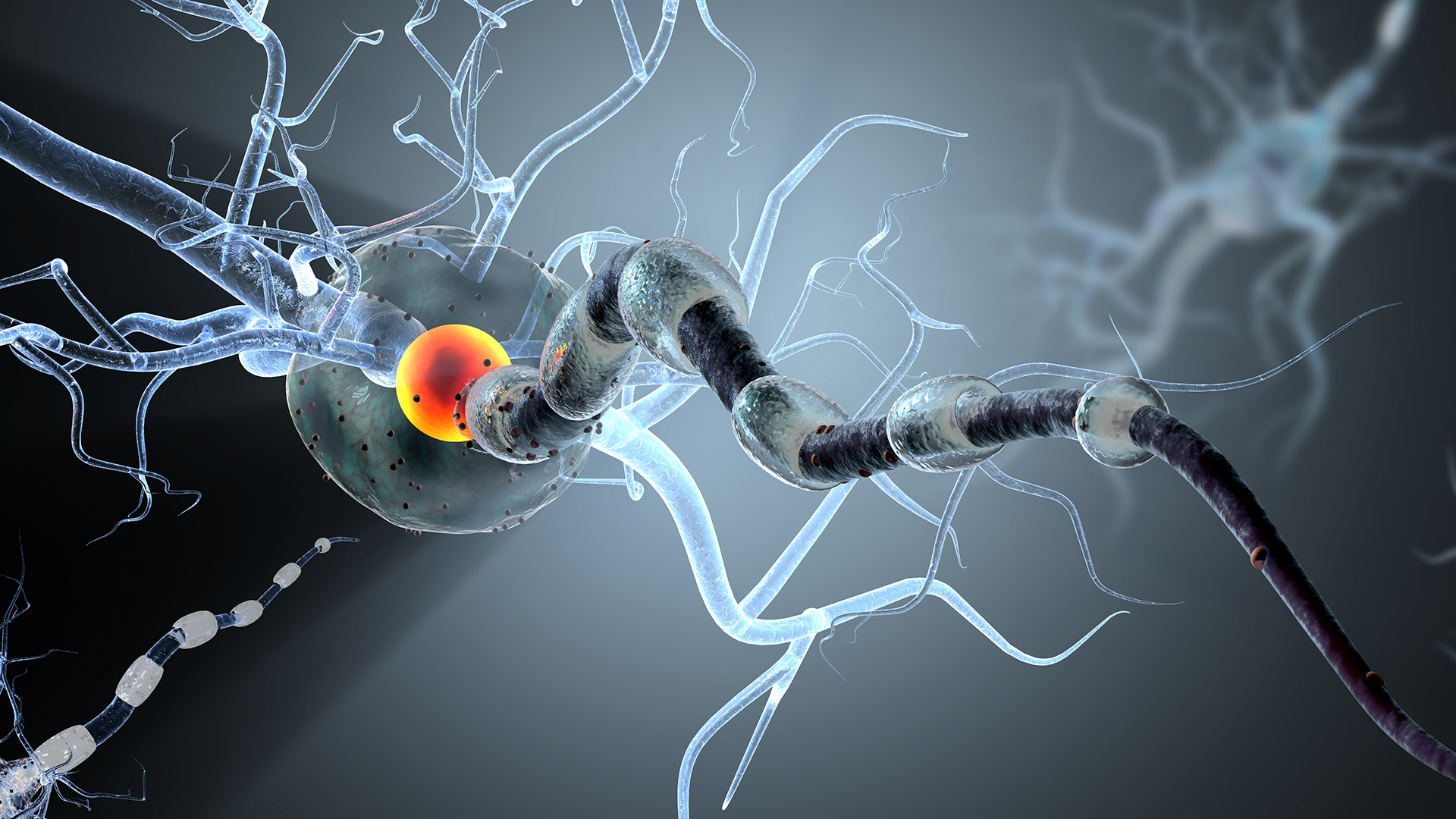 La ELA es una patología progresiva del sistema nervioso que afecta las células nerviosas en el cerebro y la médula espinal (Shutterstock)
