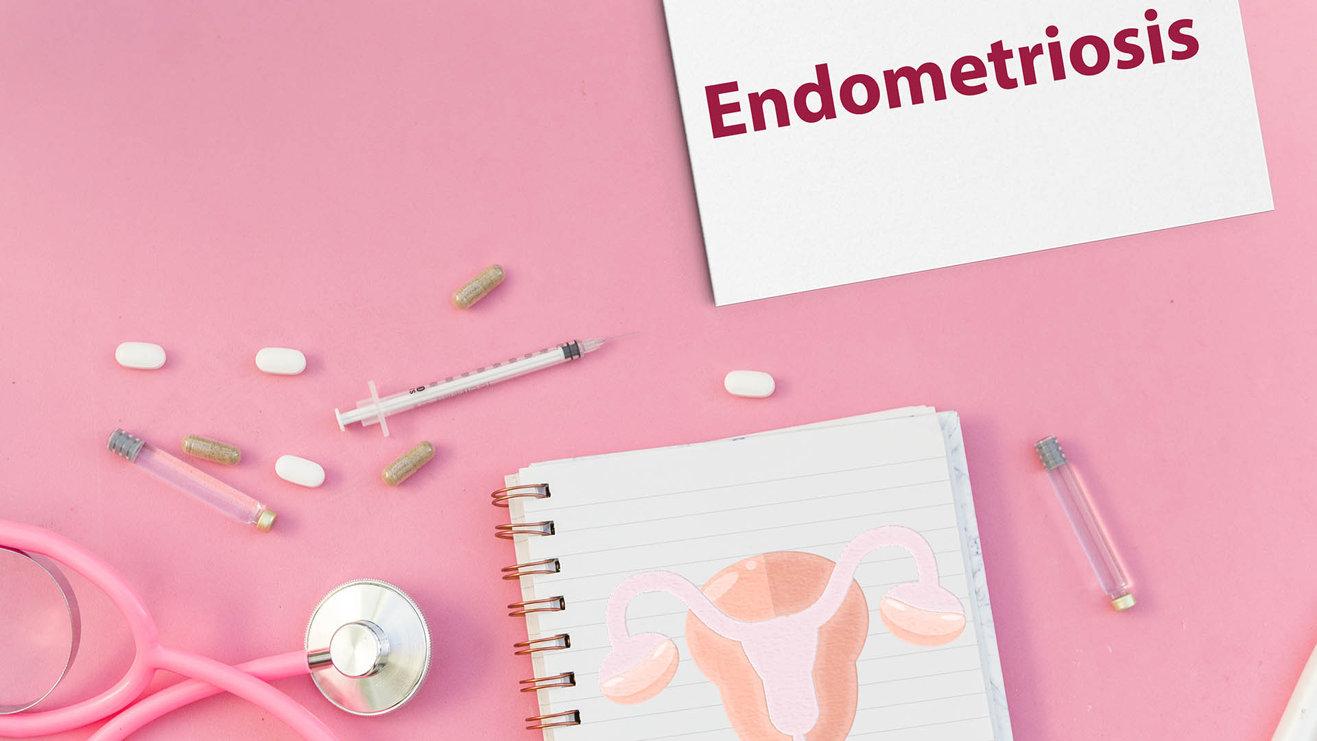 Se calcula que 170 millones de mujeres en el mundo padecen endometriosis (Getty)