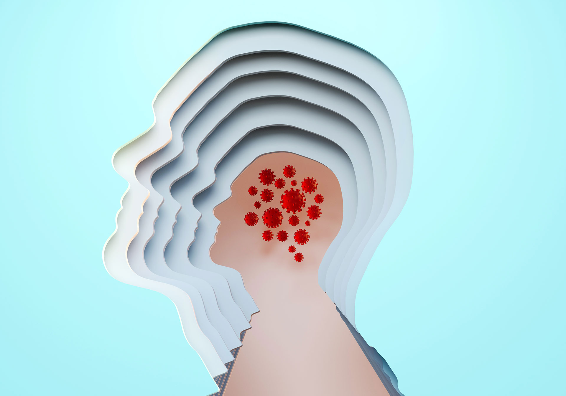 Nueva evidencia sugiere que el ataque del coronavirus al cerebro podría tener múltiples frentes: podría atacar a ciertas células cerebrales directamente, reducir el flujo sanguíneo al tejido cerebral o desencadenar la producción de moléculas inmunes que pueden dañar las células cerebrales (Getty Images)