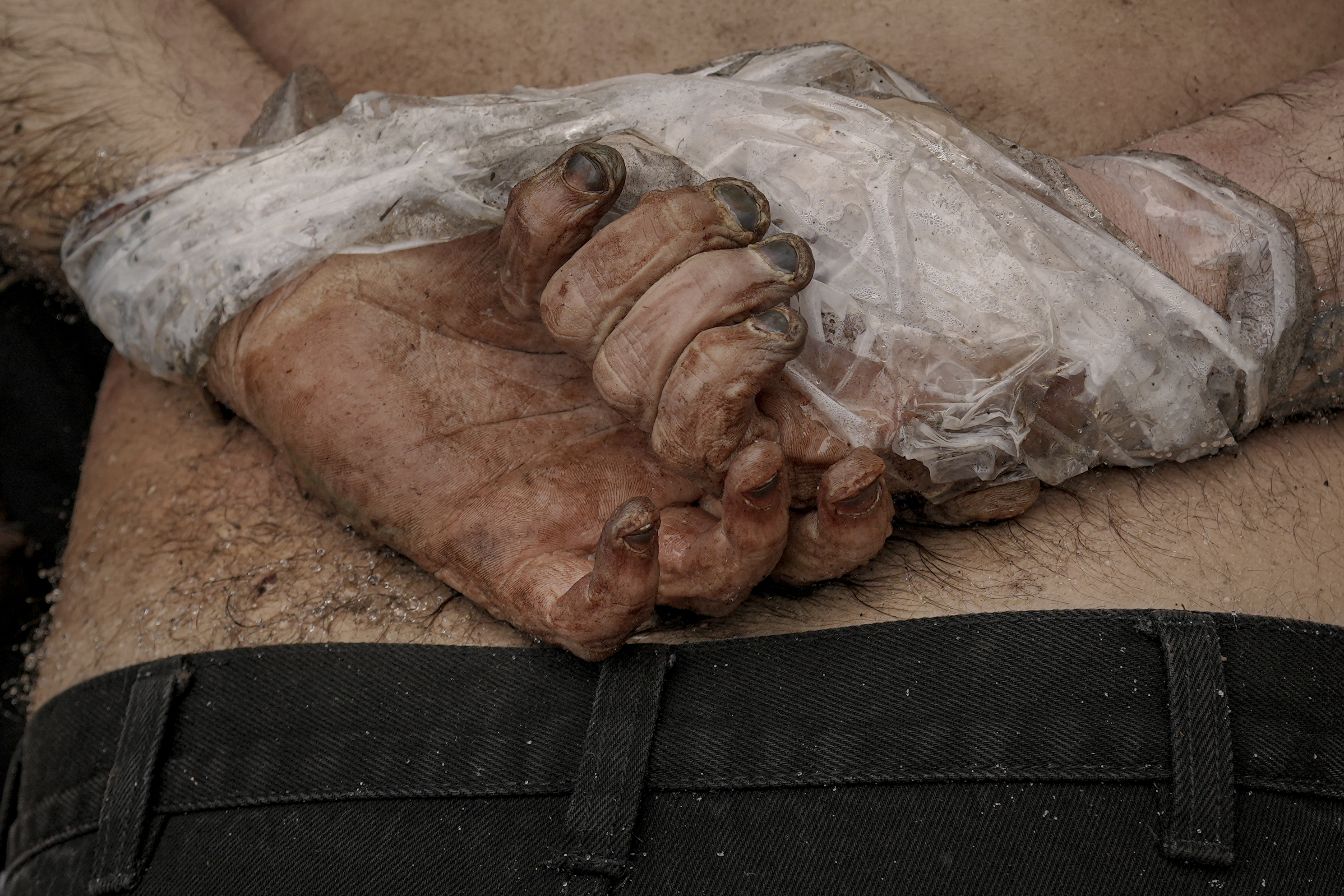 El cuerpo sin vida de un hombre con las manos atadas a la espalda yace en el suelo en Bucha, Ucrania (AP Photo/Vadim Ghirda, File)