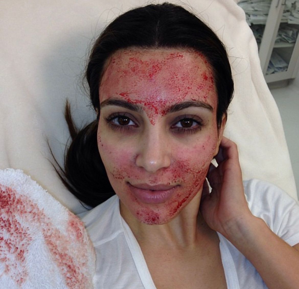 La famosa publicó el tratamiento en sus redes sociales 
(Foto: Instagram/@kimkardashian)