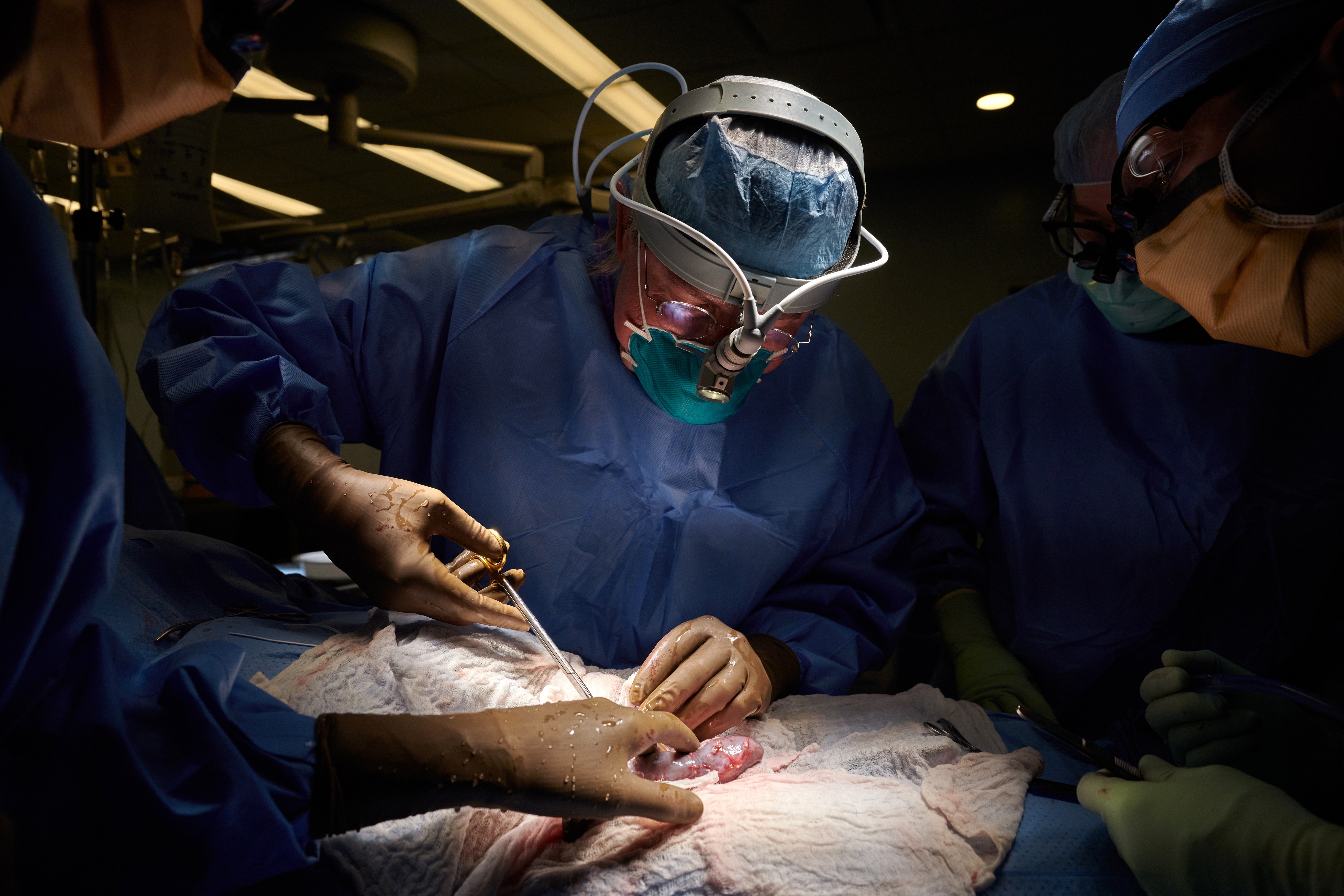 En enero de este año, un equipo de médicos de Estados Unidos realizó el primer transplante a un humano de un órgano de cerdo modificado genéticamente (EFE)

