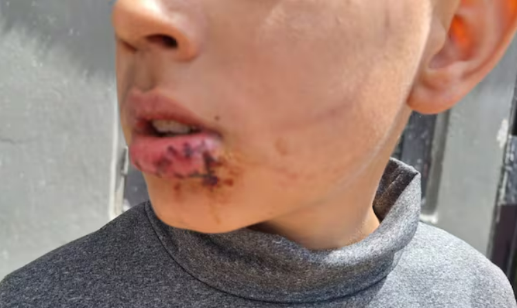 Nuevo ataque de un perro en Córdoba: un nene fue mordido por un pastor alemán mientras jugaba a la pelota