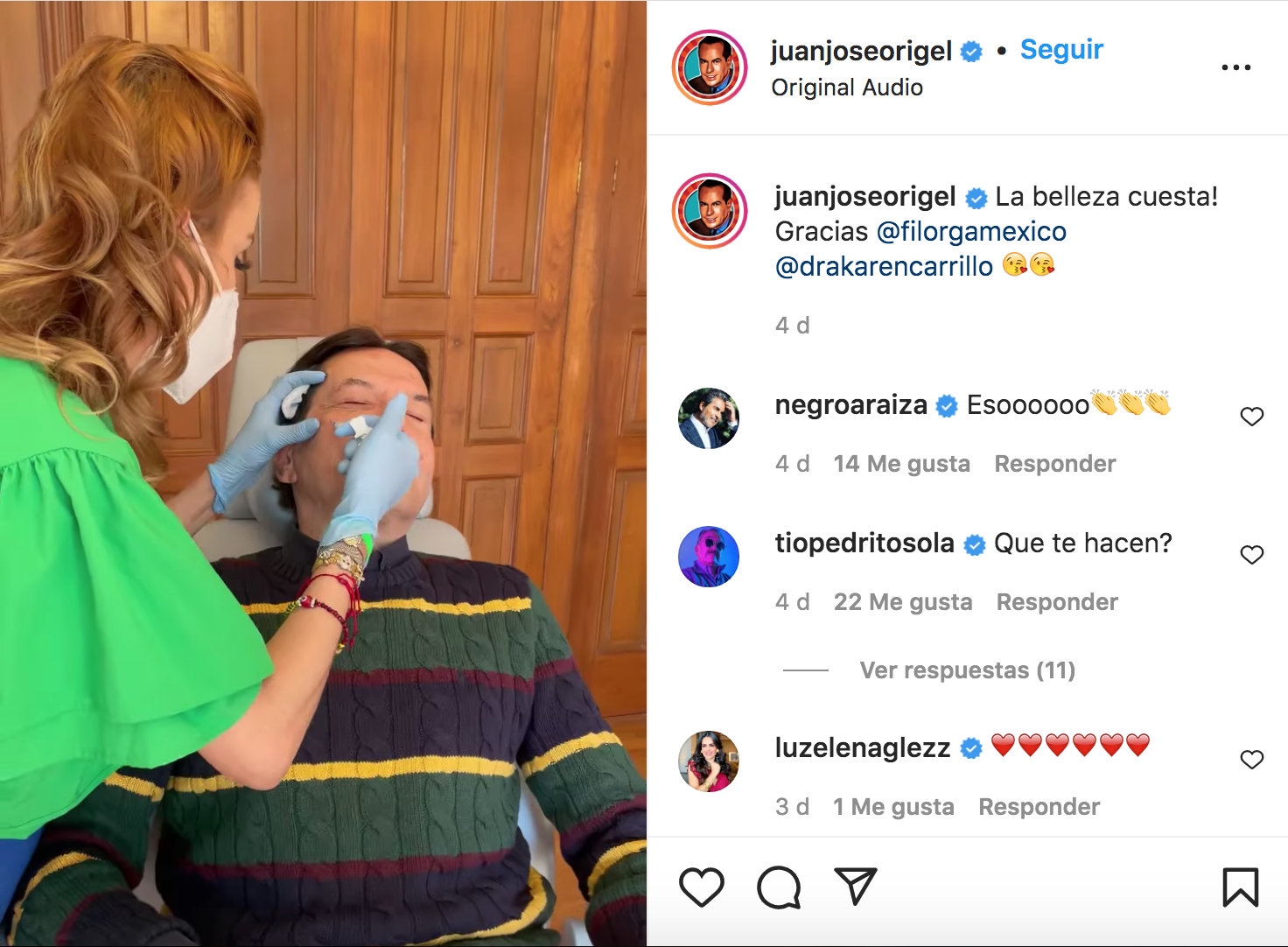 Pepillo fue criticado por inyectarse bótox (Foto: Instagram/@juanjoseorigel)