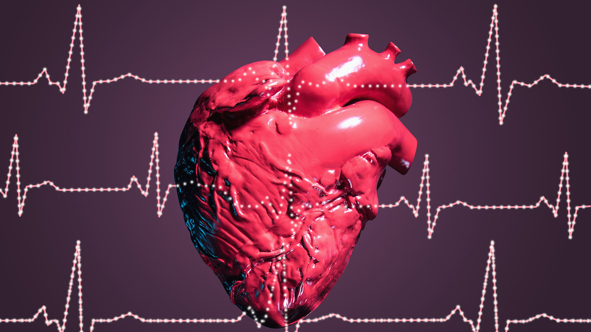 Las personas que tuvieron COVID-19 tienen un mayor riesgo de desarrollar complicaciones cardiovasculares dentro del primer mes a un año después de la infección (Getty)