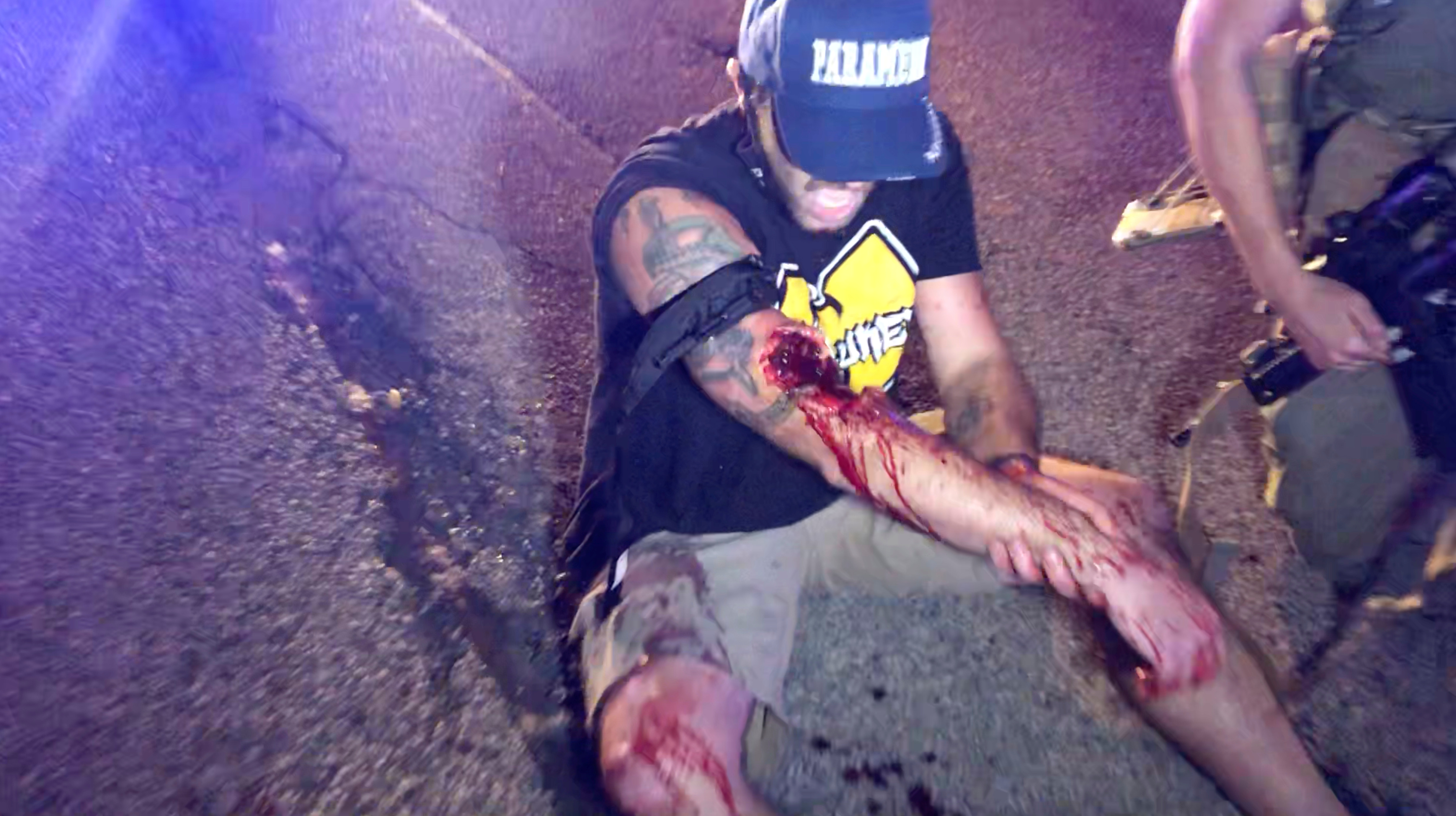 Uno de los heridos grita momento después de recibir un disparo de arma de fuego (INSTAGRAM / @LOURIEALEX/via REUTERS)
