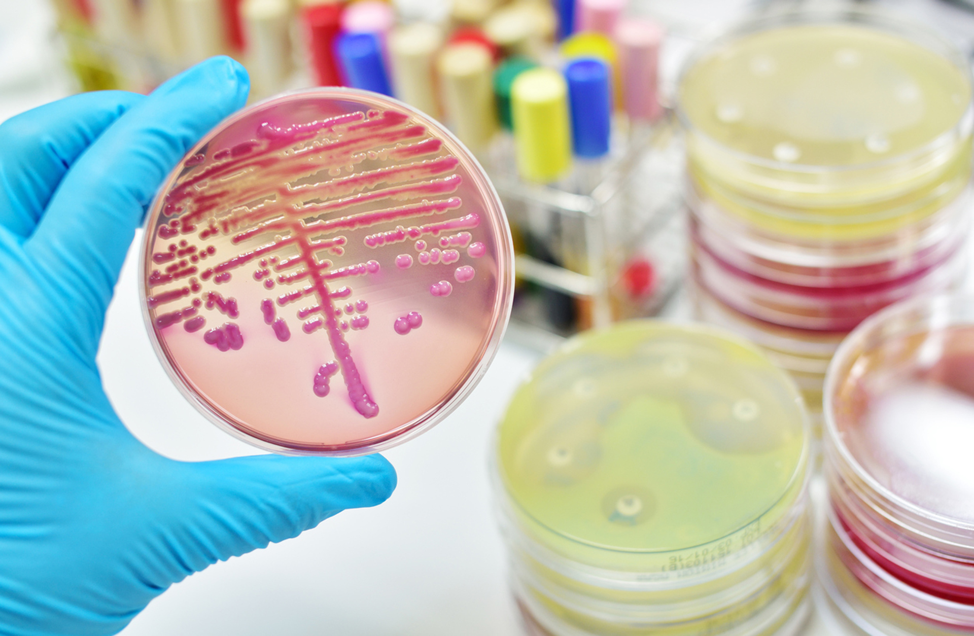 Con los datos actuales, los expertos se inclinan por dos hipótesis: un agente infeccioso (virus o bacteria) intrahospitalario o un nuevo germen (iStock)