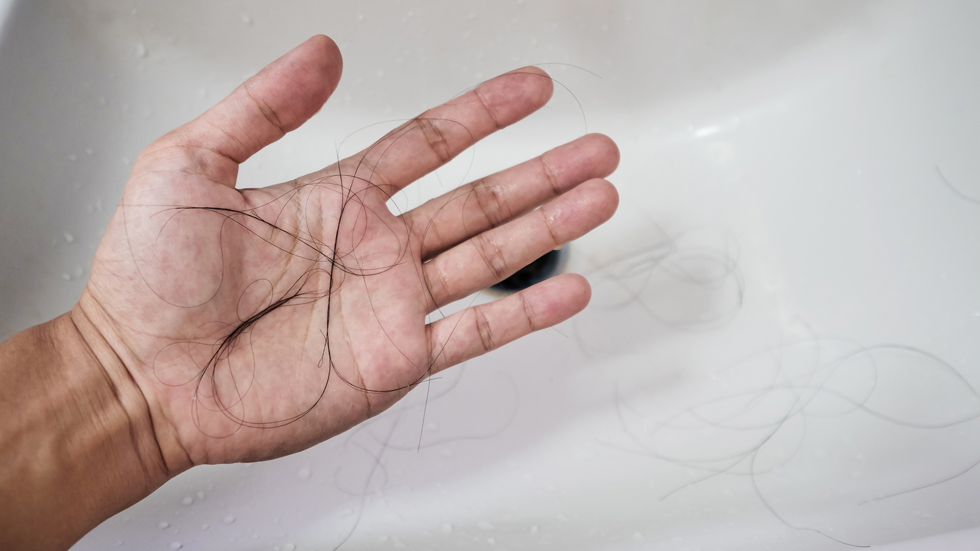 Existen opciones para contrarrestar la caída del cabello, así como tips para evitar la alopecia (Archivo)