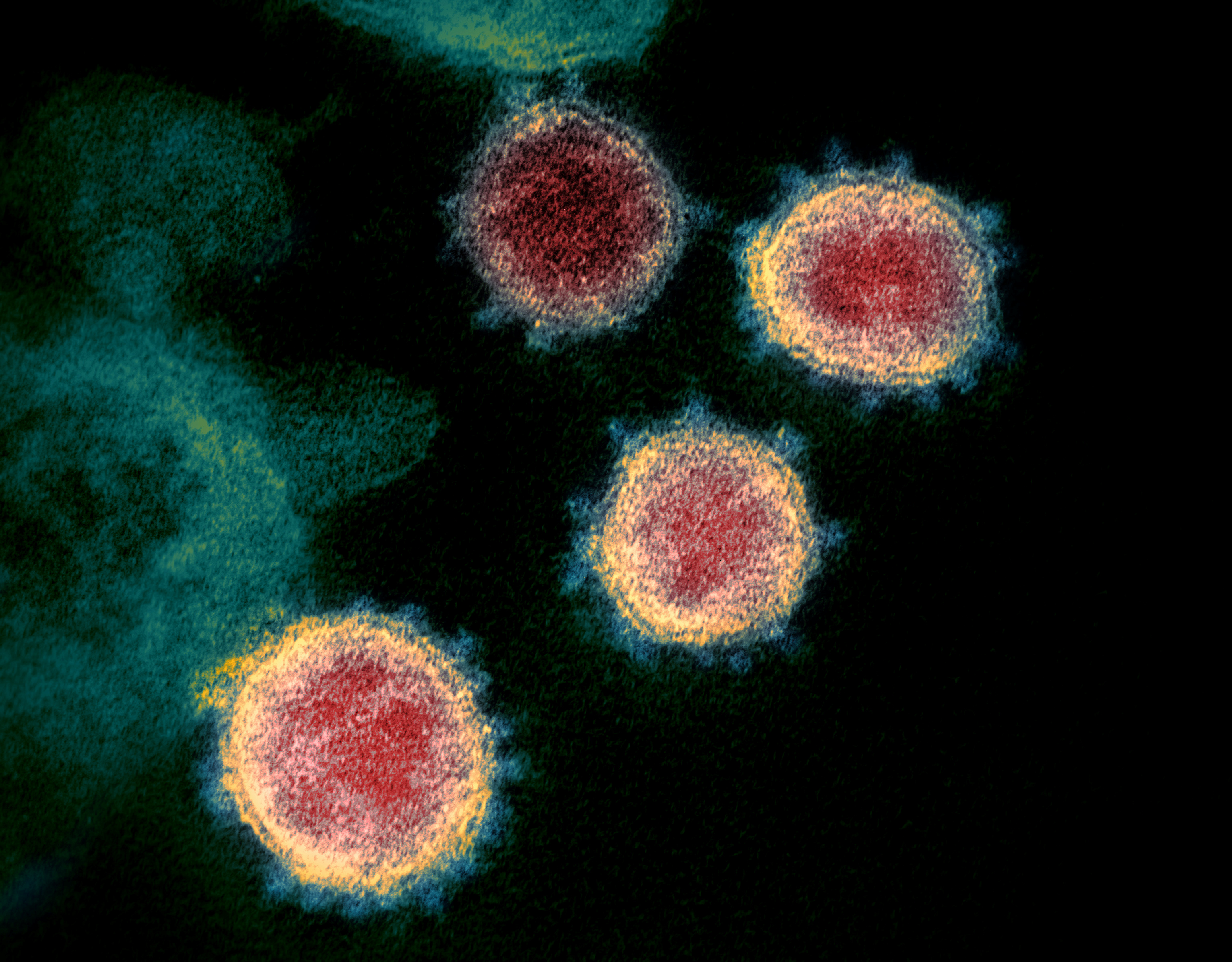 Cuál es el rol de las variantes más contagiosas de Ómicron
NIAID-RML/Handout via REUTERS. 