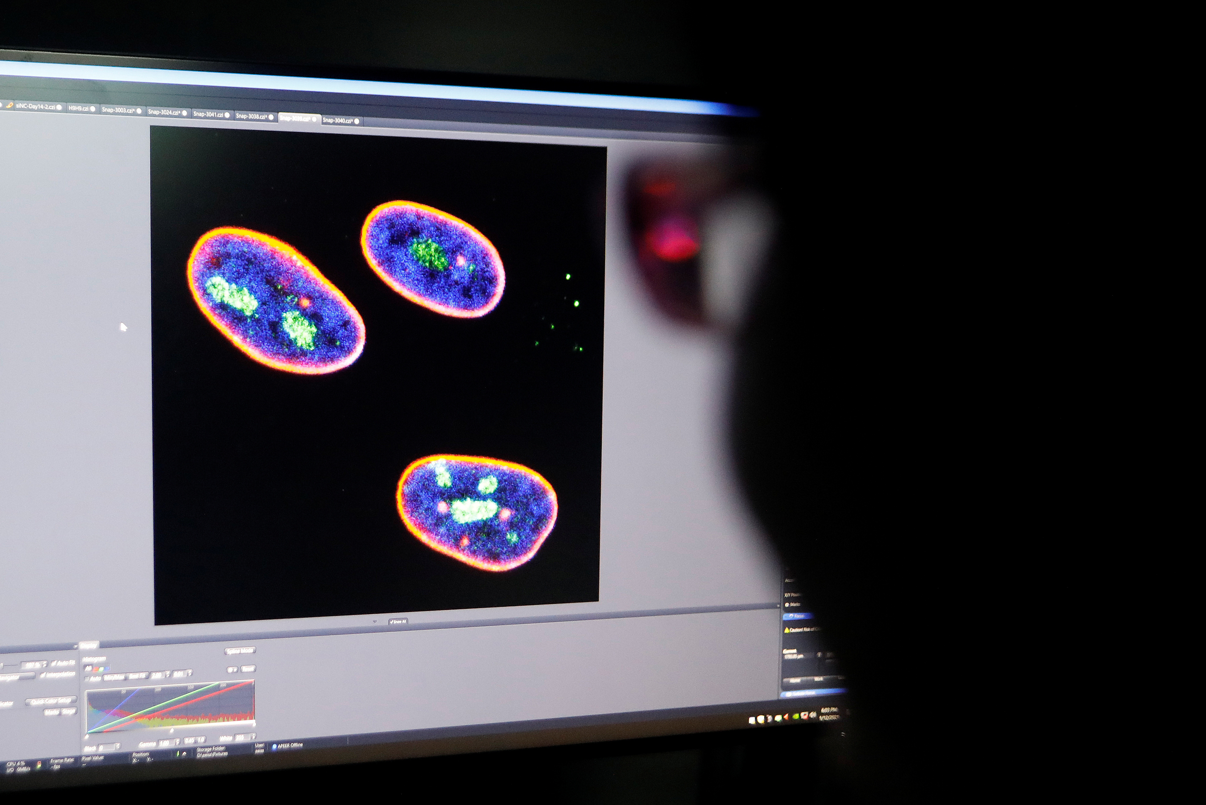 Un investigador observa la imagen confocal en una pantalla que muestra el núcleo de células madre en el laboratorio de Envejecimiento y Regeneración del Instituto de Células Madre y Regeneración de la Academia China de Ciencias (CAS) en Beijing (REUTERS/Tingshu Wang)