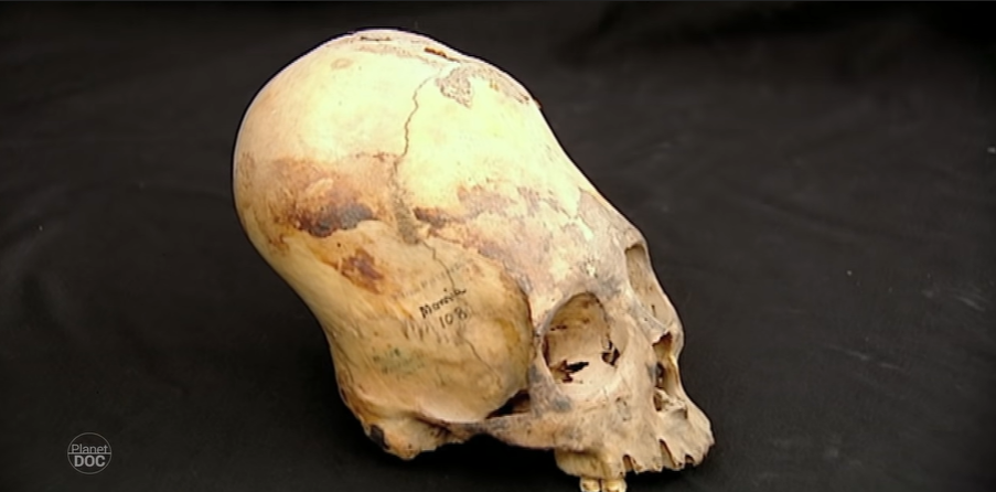 Cráneos Alargados. Precursores del Inca. (Planet Doc)