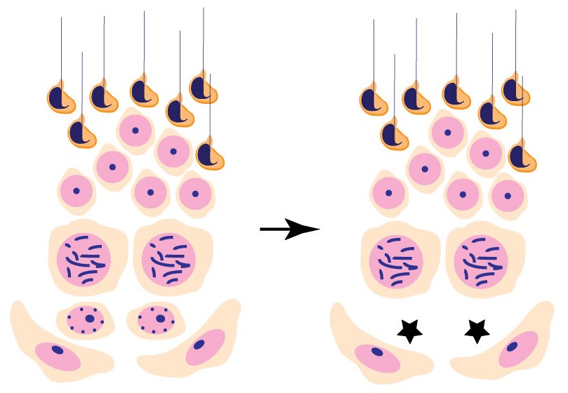Cuando la enzima DOT1L no es funcional, las células madre espermatogonias se agotan, y provoca un fallo en el desarrollo de los espermatozoides Jeremy Wang)