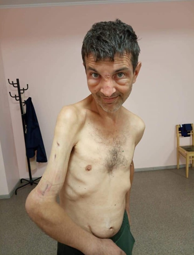 Mykhailo Dianov after being released from Russian captivity
