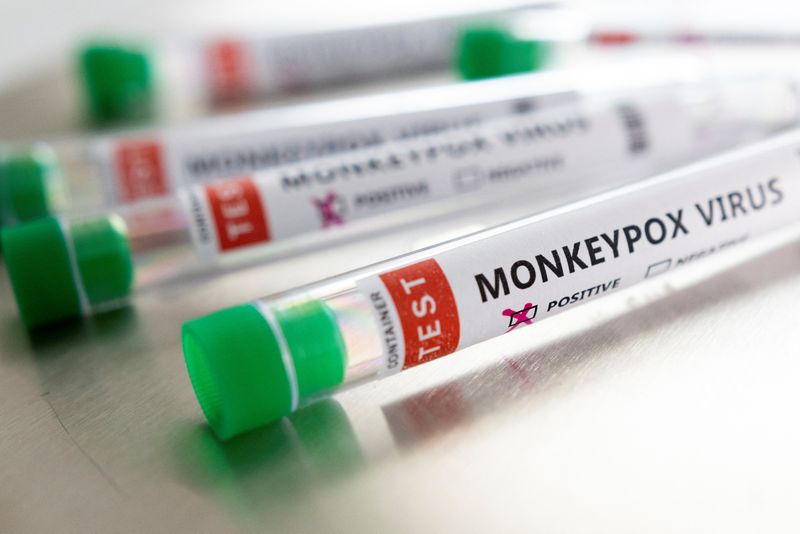La Viruela del Mono"  solo puede ser confirmada mediante una prueba PCR . (Foto: REUTERS/Dado Ruvic)