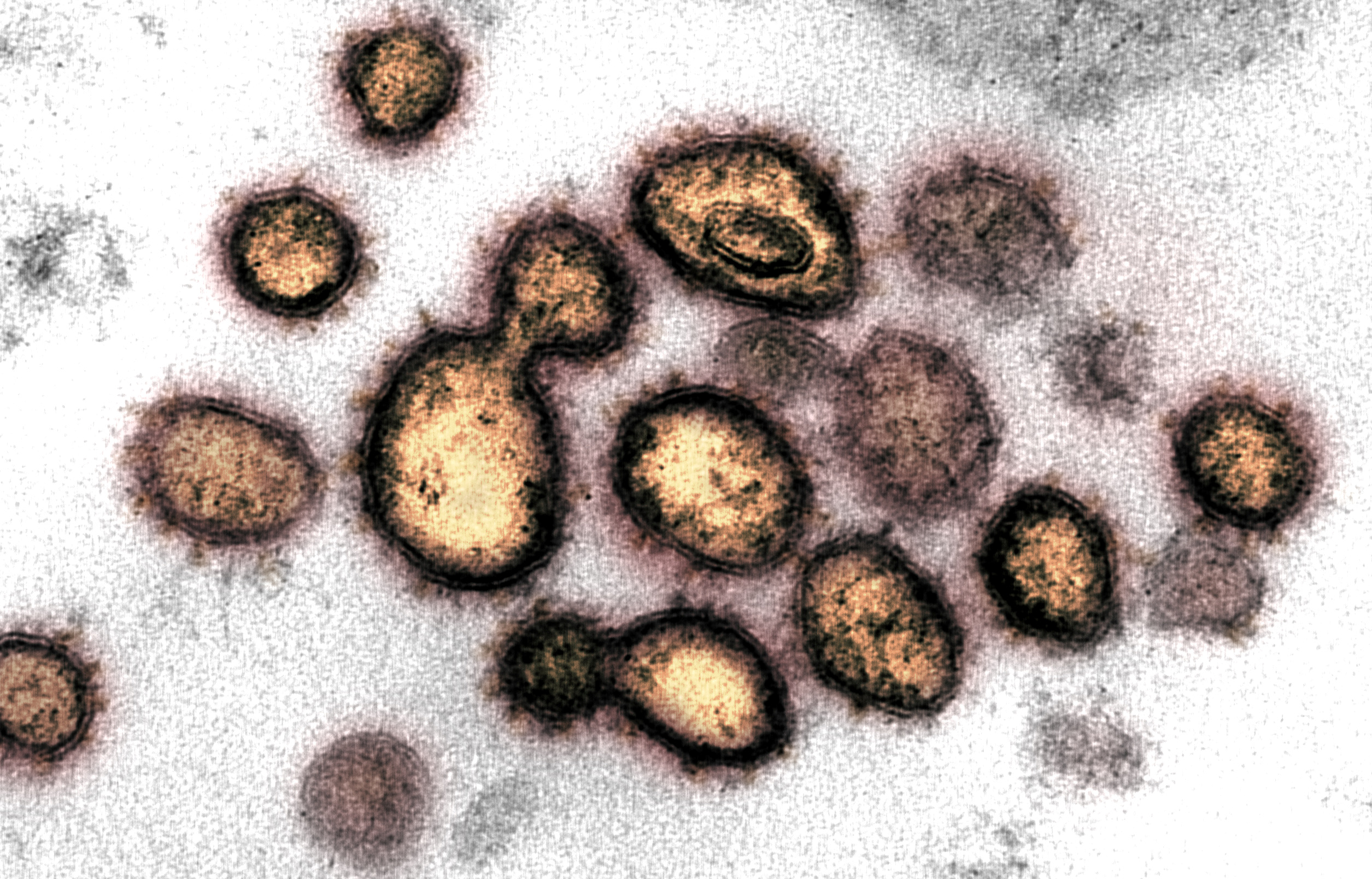 Observación del coronavirus bajo un microscopio electrónico (NIAID-RML/Handout via REUTERS. )