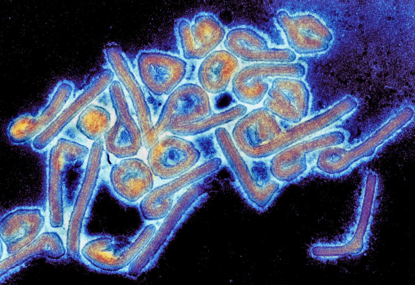 Una imagen del virus de Marburgo que fue descripto por primera vez en 1967 (Tom Geisbert, University of Texas Medical Branch)