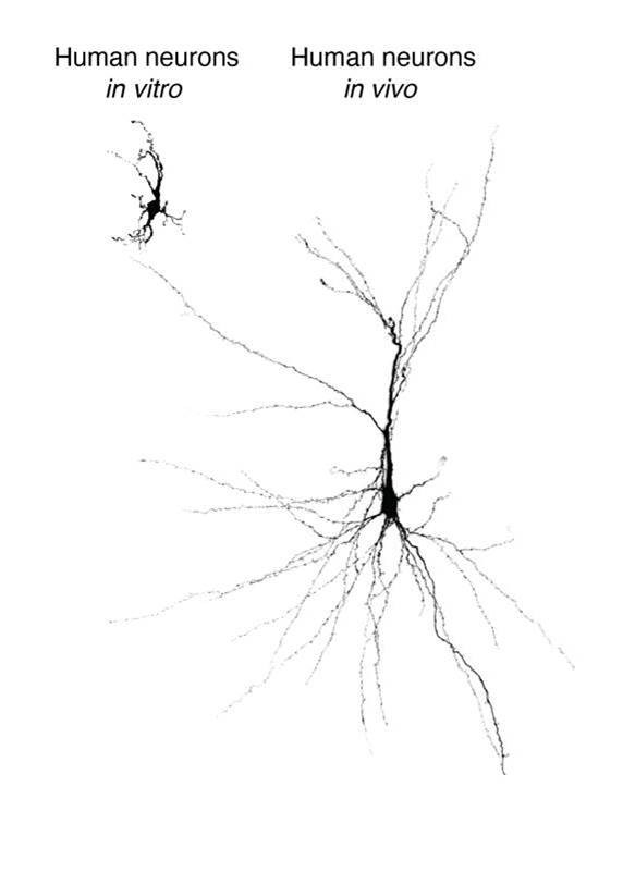 Las neuronas humanas creadas a partir de células madre y trasplantadas a un cerebro de rata (derecha) crecen más plenamente que las cultivadas en una placa (izquierda)/Universidad de Stanford
