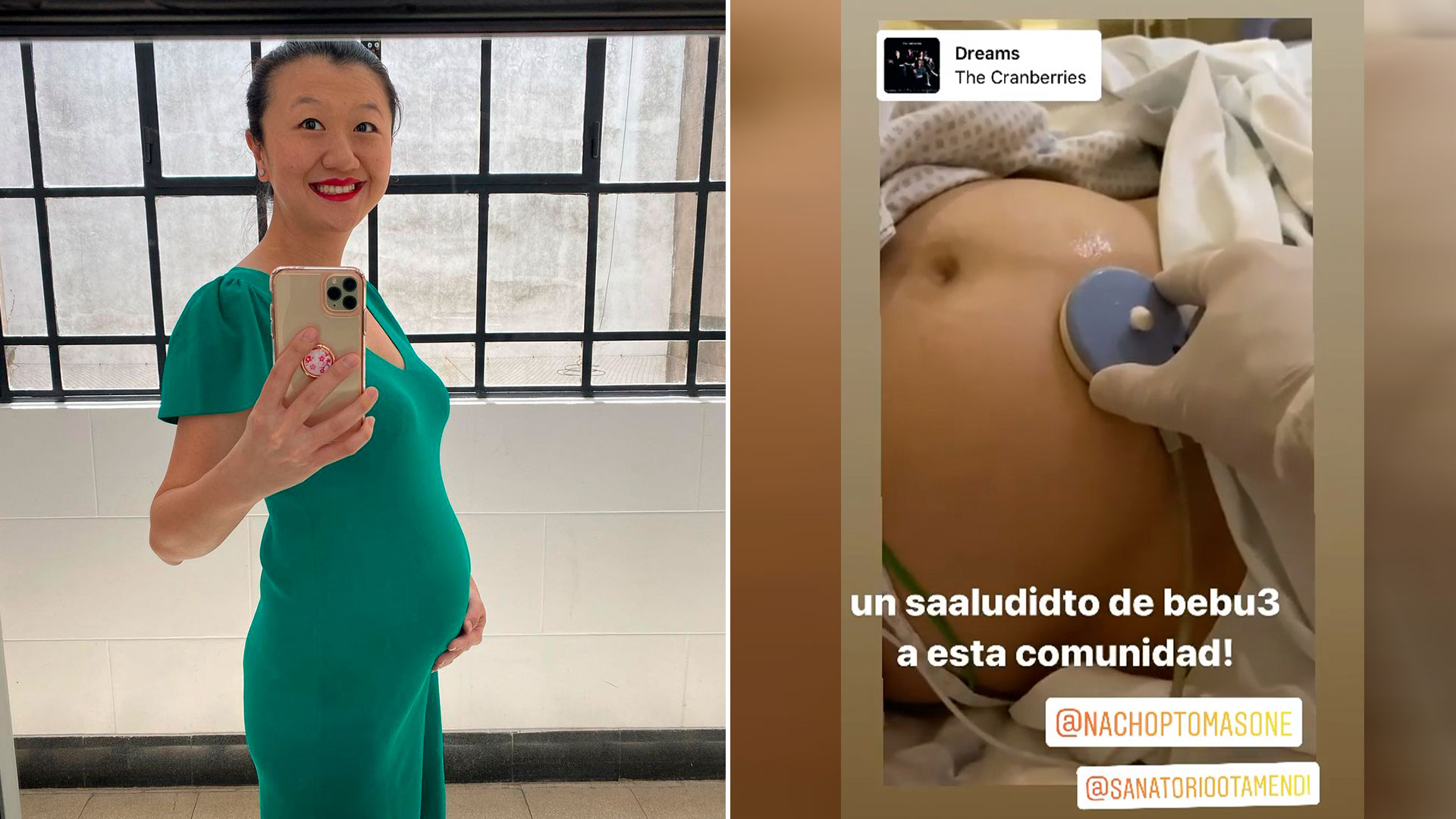 El emotivo video de Karina Gao mientras le hacían un monitoreo a su bebé 