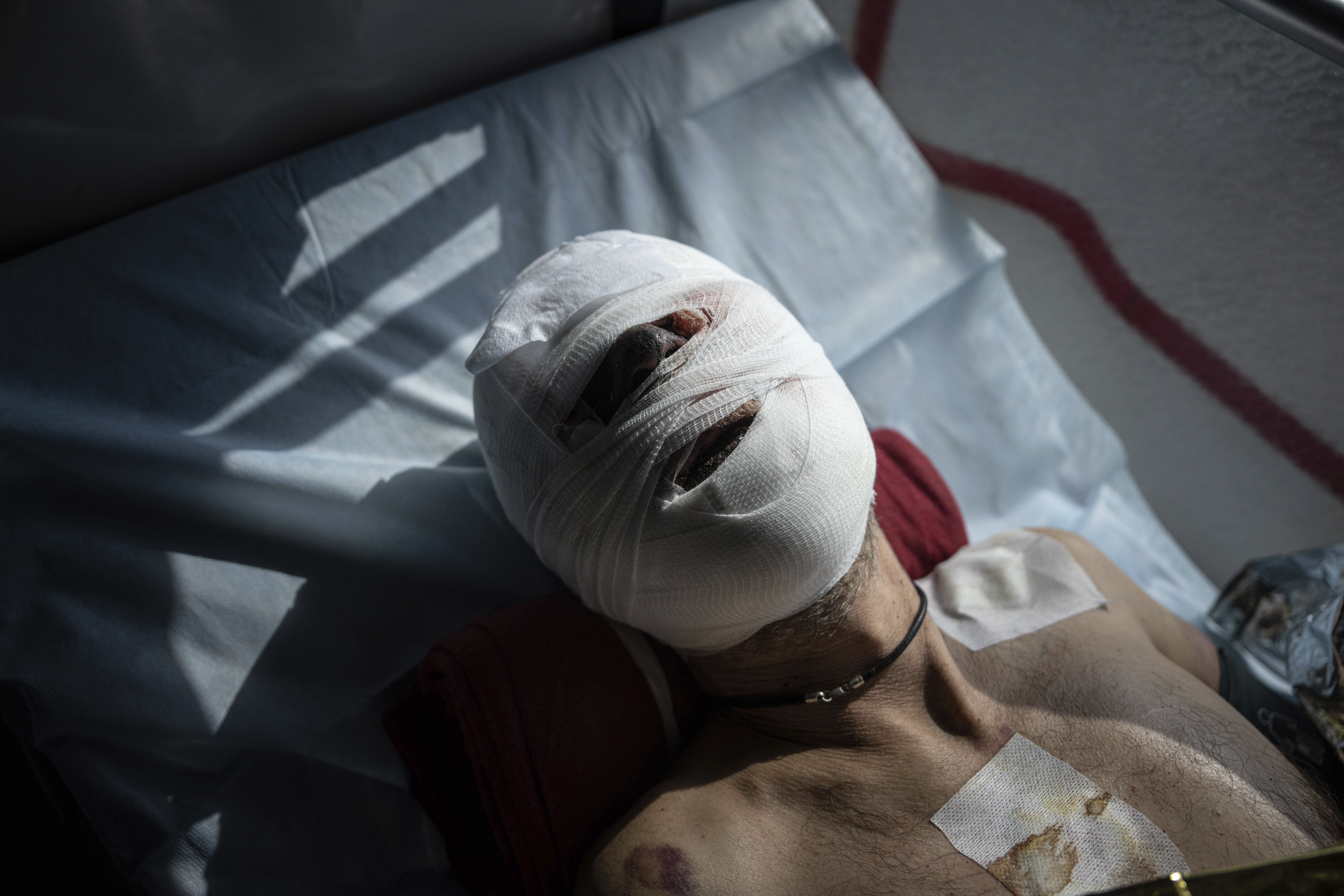 Un soldado ucraniano herido se ve tumbado en un autobús medicalizado de evacuación gestionado por voluntarios de la organización paramédica Hospitallers en Donetsk, Ucrania, el miércoles 22 de marzo de 2023. (AP Foto/Evgeniy Maloletka)