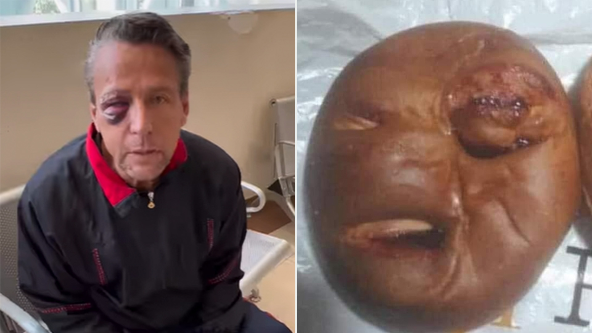The creators of this viral dessert made the bread look like the former host's swollen face "today" Credit: (Instagram/@adamereacciona and Facebook/clubdecochis)