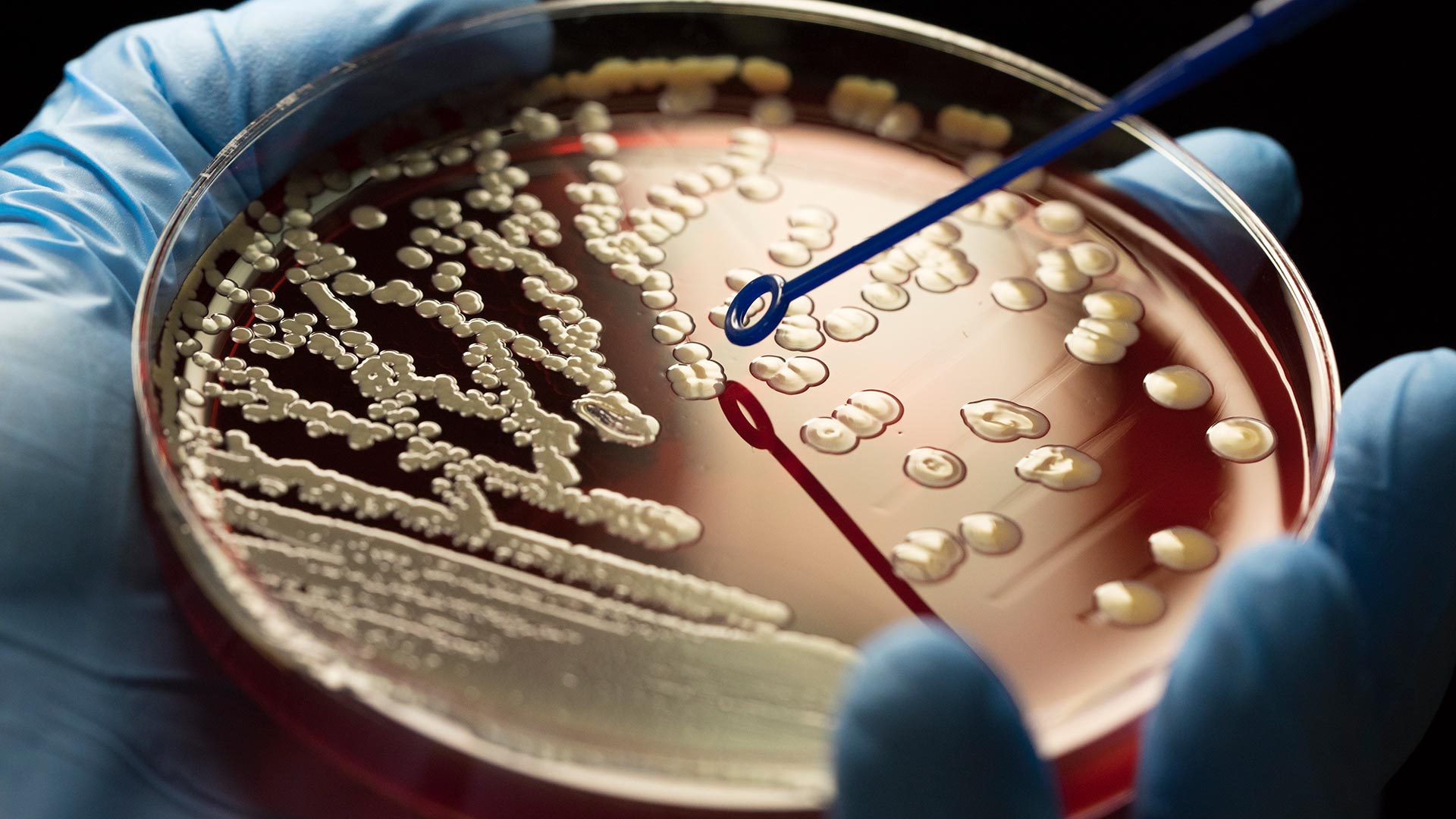 Nosocomial infections have increased since 2020 (Getty Images)