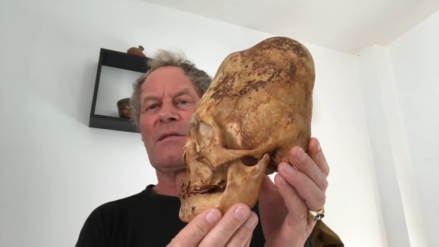 Brien Foerster sosteniendo un cráneo alargado de Paracas.