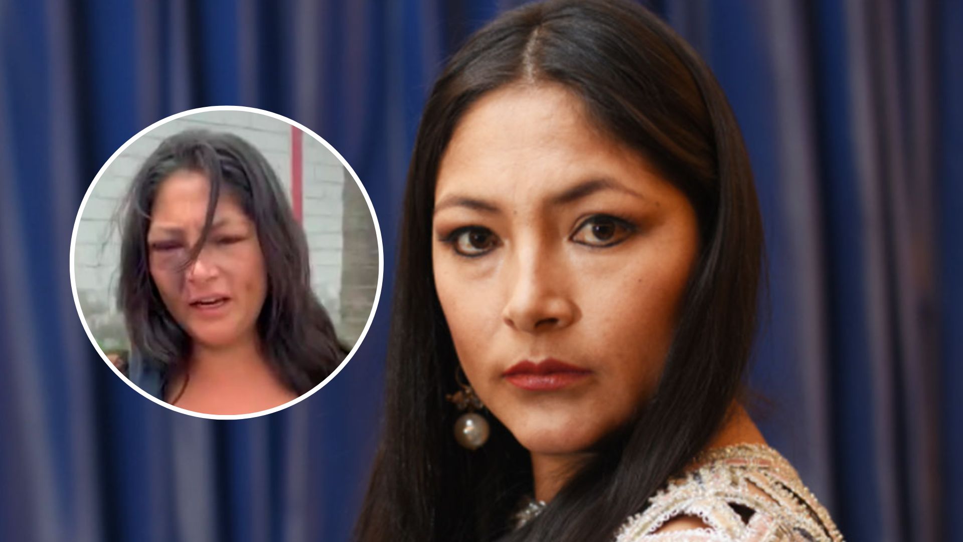Magaly Solier será operada de emergencia en Lima tras ser captada con el rostro desfigurado