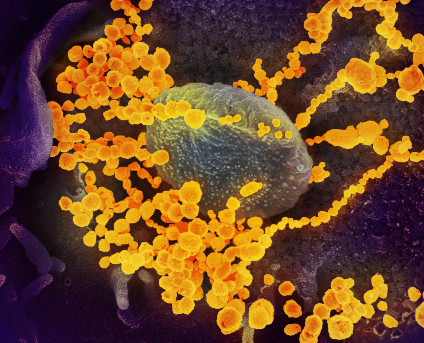 Le coronavirus observé au microscope électronique (NIAID)